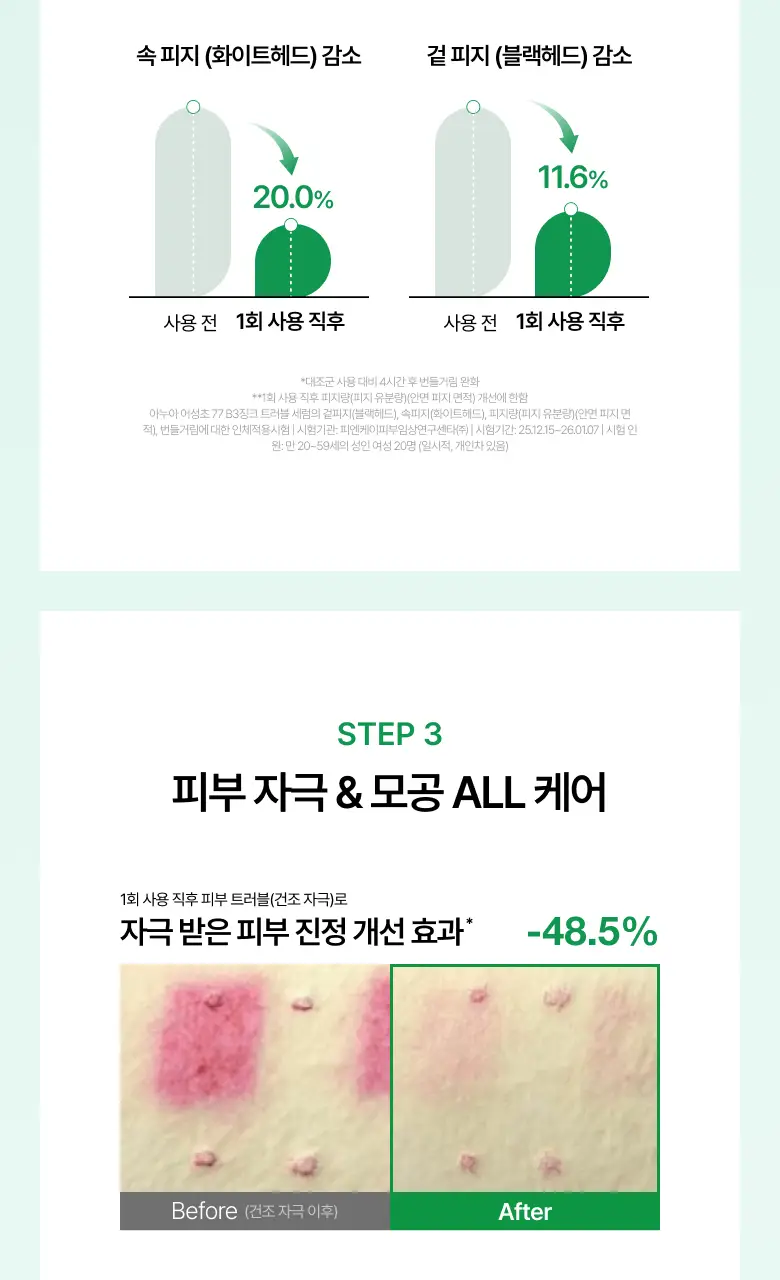 [NEW/리뉴얼] 아누아 어성초 77 B3 징크 트러블 세럼 30ml 상세페이지 20